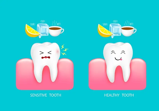 Frequent Tooth Sensitivity - Reduce Triggers and Improve Care
